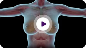 biotech-video-reconstruccion-mamaria
